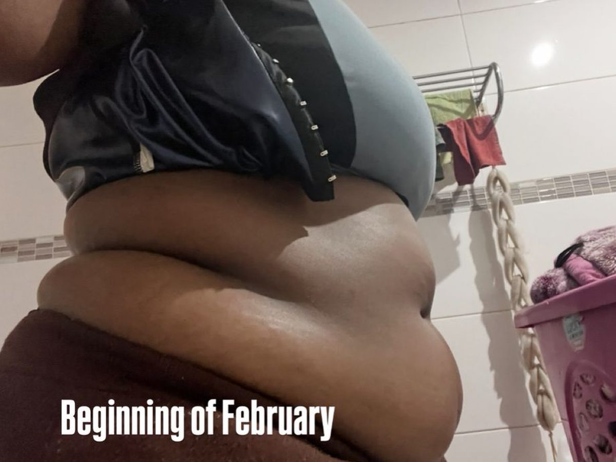 Client photo, beginning of February — before starting Metabo daily drops.
